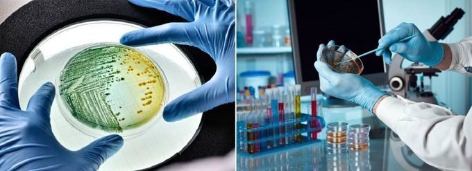 Лабалаторный анализ на дисбактериоз